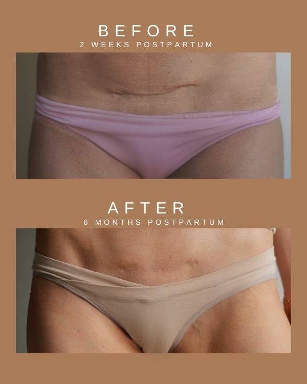 C-Section